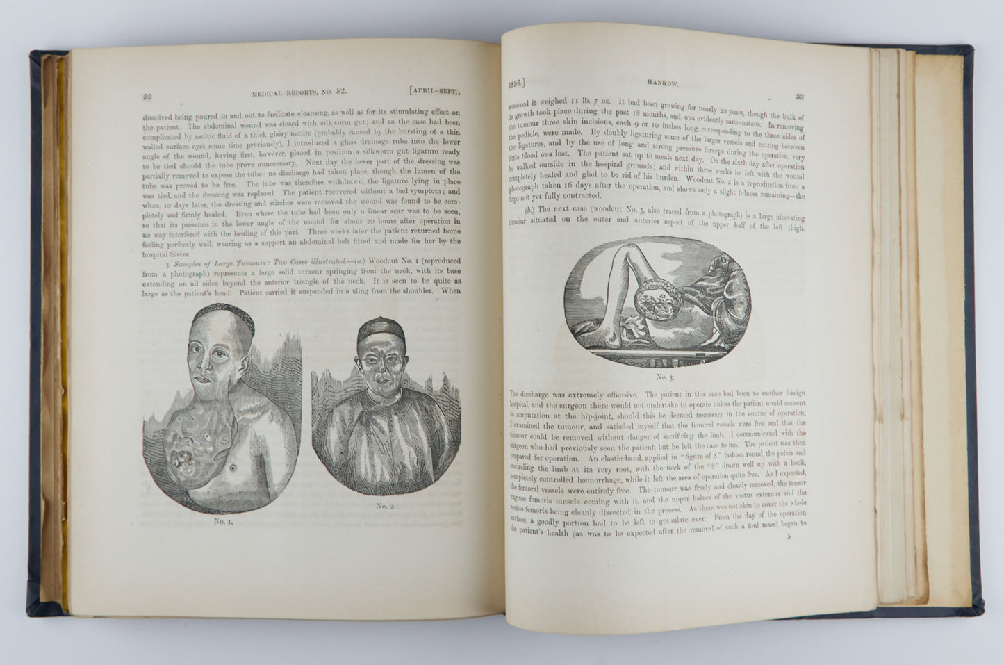 China Imperial Maritime Customs Medical Reports (1893-1904), Issues 45–67, in 3 Volumes