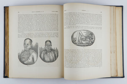 China Imperial Maritime Customs Medical Reports (1893-1904), Issues 45–67, in 3 Volumes