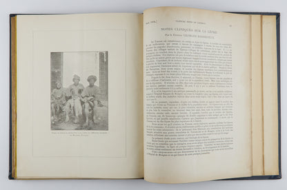 China Imperial Maritime Customs Medical Reports (1893-1904), Issues 45–67, in 3 Volumes